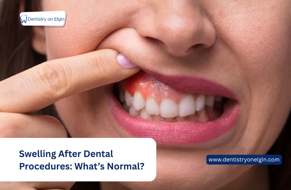 Swelling After Dental Procedures: What’s Normal and When Should You Be Concerned?